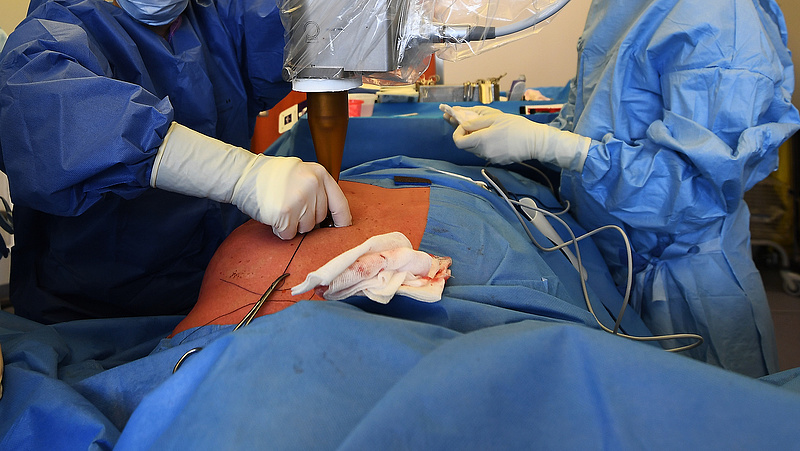Egy kivételével az összes sebész felmondott az egyik Budapesti kórházban (frissítve)