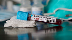 Koronavírus: jó hír jött Kínából