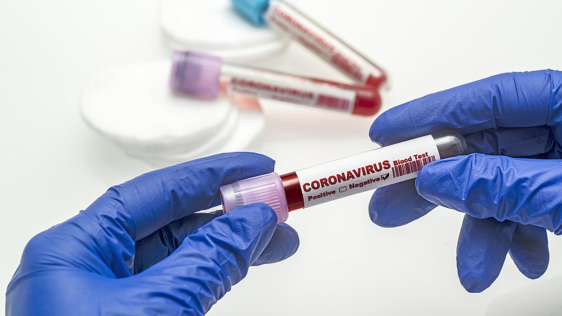 Ezért nem végeznek tömegesen koronavírus-tesztet Magyarországon