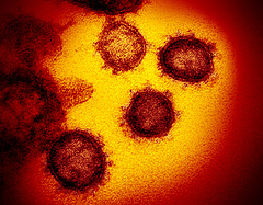 Koronavírus: két tanulmány is durva adatokat mutat az indiai variánsról