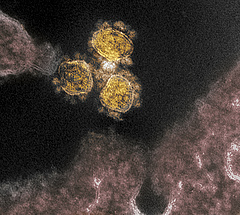 Koronavírus: megjelentek a friss, nemzetközi adatok