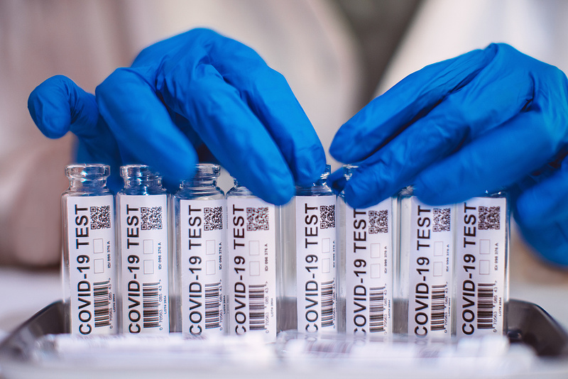 A WHO új vizsgálatot indít a koronavírus eredetének feltárására