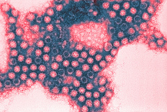 Koronavírus: új adatok érkeztek, gyorsabban terjed a járvány 
