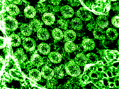 Koronavírus: jelentősen mutálódott változatra bukkantak