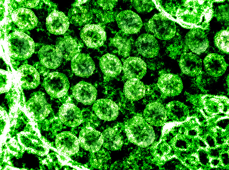 Koronavírus: 246 új fertőzöttet talátak, 4 beteg meghalt