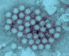 Japánban elterjedt egy új nairovírus, ami rovarcsípéseken keresztül terjed