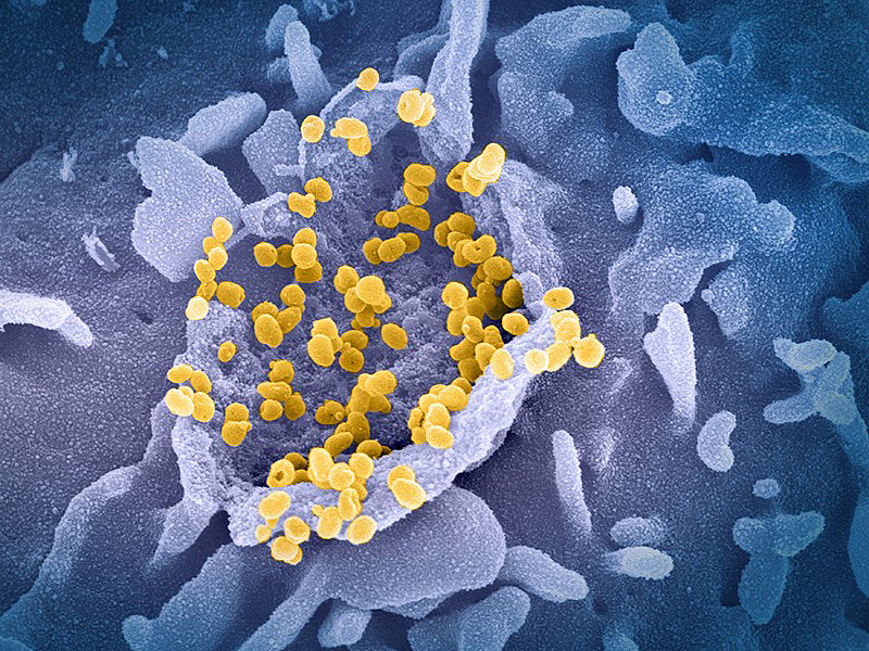 Koronavírus: újabb országokat talált járványügyi szempontból biztonságosnak az EU
